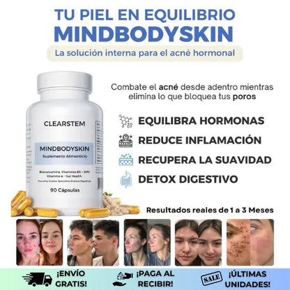 Mindbodyskin® | Reduce el acné desde la raíz y empieza a ver tu piel más limpia en la 3 semana ¡Oferta 2x1!
